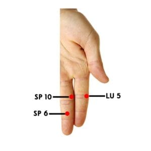 Stress-Acne-and-Dandruff